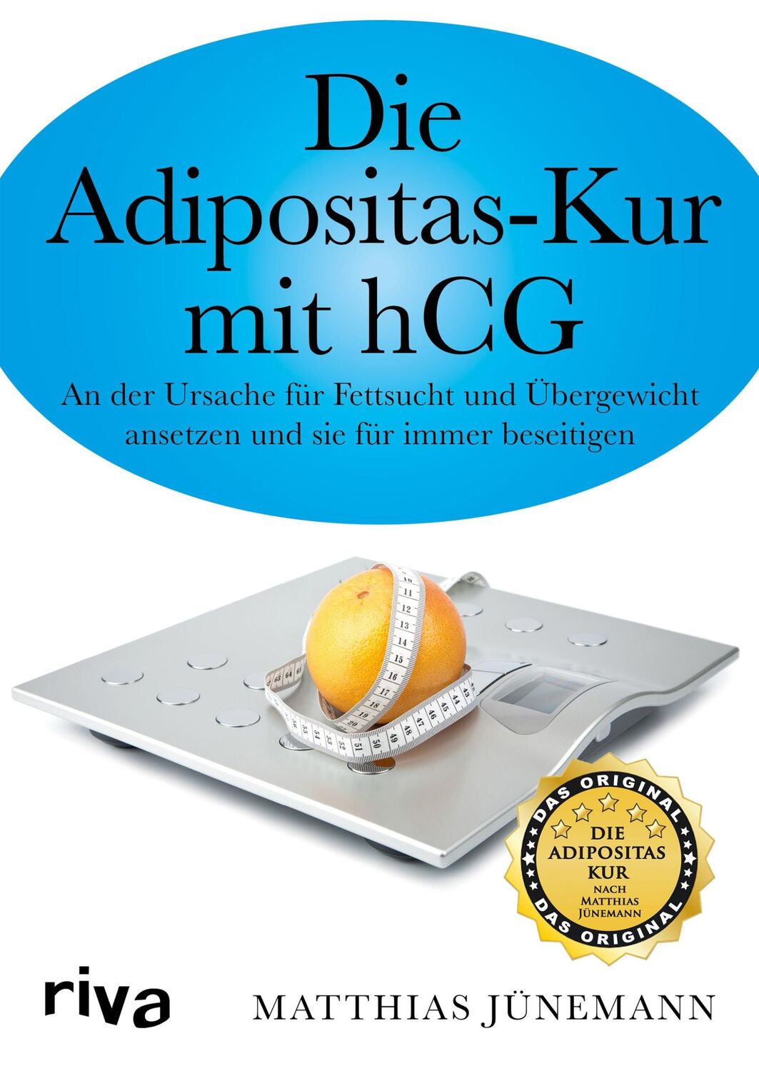 Cover: 9783868835977 | Die Adipositas-Kur mit HCG | Matthias Jünemann | Taschenbuch | 176 S.